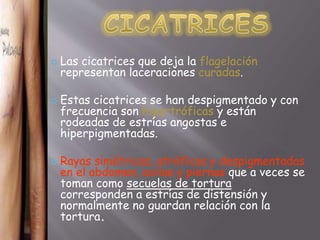  Las cicatrices que deja la flagelación 
representan laceraciones curadas. 
 Estas cicatrices se han despigmentado y con 
frecuencia son hipertróficas y están 
rodeadas de estrías angostas e 
hiperpigmentadas. 
 Rayas simétricas, atróficas y despigmentadas 
en el abdomen, axilas y piernas que a veces se 
toman como secuelas de tortura 
corresponden a estrías de distensión y 
normalmente no guardan relación con la 
tortura. 
 