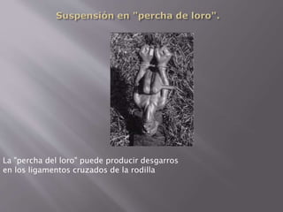 La "percha del loro" puede producir desgarros 
en los ligamentos cruzados de la rodilla 
 