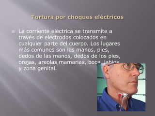  La corriente eléctrica se transmite a 
través de electrodos colocados en 
cualquier parte del cuerpo. Los lugares 
más comunes son las manos, pies, 
dedos de las manos, dedos de los pies, 
orejas, areolas mamarias, boca, labios 
y zona genital. 
 