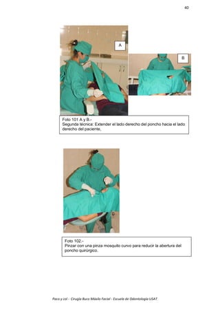 40




                                           A


                                                                           B




      Foto 101 A y B.-
      Segunda técnica: Extender el lado derecho del poncho hacia el lado
      derecho del paciente,




        Foto 102.-
        Pinzar con una pinza mosquito curvo para reducir la abertura del
        poncho quirúrgico.




Paco y col - Cirugía Buco Máxilo Facial - Escuela de Odontología USAT
 
