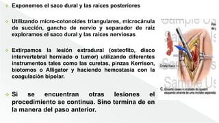  Exponemos el saco dural y las raíces posteriores
 Utilizando micro-cotonoides triangulares, microcánula
de succión, gancho de nervio y separador de raíz
exploramos el saco dural y las raíces nerviosas
 Extirpamos la lesión extradural (osteofito, disco
intervertebral herniado o tumor) utilizando diferentes
instrumentos tales como las curetas, pinzas Kerrison,
biotomos o Alligator y haciendo hemostasia con la
coagulación bipolar.
 Si se encuentran otras lesiones el
procedimiento se continua. Sino termina de en
la manera del paso anterior.
 