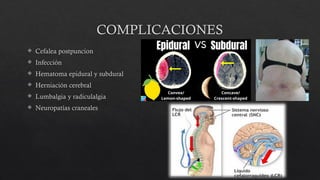 COMPLICACIONES
 Cefalea postpuncion
 Infección
 Hematoma epidural y subdural
 Herniación cerebral
 Lumbalgia y radiculalgia
 Neuropatías craneales
 