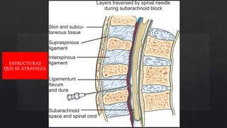 ESTRUCTURAS
QUE SE ATRAVIEZA
 