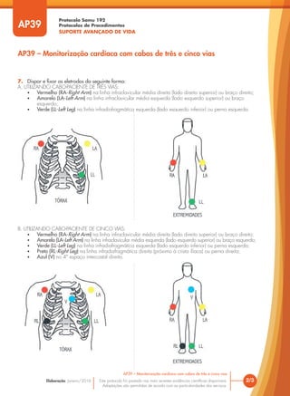 Protocolo Samu 192
Protocolos de Procedimentos
SUPORTE AVANÇADO DE VIDA
Este protocolo foi pautado nas mais recentes evidências científicas disponíveis.
Adaptações são permitidas de acordo com as particularidades dos serviços.
Elaboração: Janeiro/2016
AP39
AP39 – Monitorização cardíaca com cabos de três e cinco vias
2/3
AP39 – Monitorização cardíaca com cabos de três e cinco vias
7. Dispor e fixar os eletrodos da seguinte forma:
A. UTILIZANDO CABO-PACIENTE DE TRÊS VIAS:
• Vermelho (RA-Right Arm) na linha infraclavicular média direita (lado direito superior) ou braço direito;
• Amarelo (LA-Left Arm) na linha infraclavicular média esquerda (lado esquerdo superior) ou braço
esquerdo;
• Verde (LL-Left Leg) na linha infradiafragmática esquerda (lado esquerdo inferior) ou perna esquerda.
B. UTILIZANDO CABO-PACIENTE DE CINCO VIAS:
• Vermelho (RA-Right Arm) na linha infraclavicular média direita (lado direito superior) ou braço direito;
• Amarelo (LA-Left Arm) na linha infraclavicular média esquerda (lado esquerdo superior) ou braço esquerdo;
• Verde (LL-Left Leg) na linha infradiafragmática esquerda (lado esquerdo inferior) ou perna esquerda;
• Preto (RL-Right Leg) na linha infradiafragmática direita (próximo à crista ilíaca) ou perna direita;
• Azul (V) no 4º espaço intercostal direito.
 