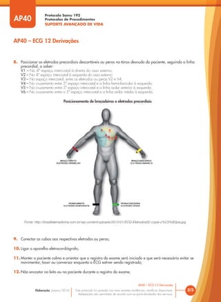 Protocolo Samu 192
Protocolos de Procedimentos
SUPORTE AVANÇADO DE VIDA
Este protocolo foi pautado nas mais recentes evidências científicas disponíveis.
Adaptações são permitidas de acordo com as particularidades dos serviços.
Elaboração: Janeiro/2016
AP40
AP40 – ECG 12 Derivações
2/3
AP40 – ECG 12 Derivações
8. Posicionar os eletrodos precordiais descartáveis ou peras no tórax desnudo do paciente, seguindo a linha
precordial, a saber:
V1 – No 4º espaço intercostal à direita do osso esterno;
V2 – No 4º espaço intercostal à esquerda do osso esterno;
V3 – No espaço intercostal, entre os eletrodos ou peras V2 e V4;
V4 – No cruzamento entre 5º espaço intercostal e a linha hemiclavicular à esquerda;
V5 – No cruzamento entre 5º espaço intercostal e a linha axilar anterior à esquerda;
V6 – No cruzamento entre o 5º espaço intercostal e a linha axilar média à esquerda;
Fonte: http://brasiltelemedicina.com.br/wp-content/uploads/2015/01/ECG-Eletrodos02-copia-c%C3%B3pia.jpg
9. Conectar os cabos aos respectivos eletrodos ou peras;
10. Ligar o aparelho eletrocardiógrafo;
11. Manter o paciente calmo e orientar que o registro do exame será iniciado e que será necessário evitar se
movimentar, tossir ou conversar enquanto o ECG estiver sendo registrado;
12. Não encostar no leito ou no paciente durante o registro do exame;
Posicionamento de braçadeiras e eletrodos precordiais
 