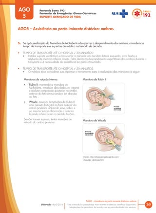 Protocolo Samu 192
Protocolos de Emergências Gineco-Obstétricas
SUPORTE AVANÇADO DE VIDA
Este protocolo foi pautado nas mais recentes evidências científicas disponíveis.
Adaptações são permitidas de acordo com as particularidades dos serviços.
Elaboração: Abril/2016 3/5
AGO5 – Assistência ao parto iminente distócico: ombros
AGO
5
AGO5 – Assistência ao parto iminente distócico: ombros
5. Se após realização da Manobra de McRoberts não ocorrer o desprendimento dos ombros, considerar o
tempo de transporte e a expertise do médico na tomada de decisão:
• TEMPO DE TRANSPORTE ATÉ O HOSPITAL < 30 MINUTOS:
• Instalar suporte ventilatório e transportar a paciente em decúbito lateral esquerdo, com flexão e
abdução de membro inferior direito. Estar atento ao desprendimento espontâneo dos ombros durante o
transporte e à necessidade de assistência ao parto consumado.
• TEMPO DE TRANSPORTE ATÉ O HOSPITAL > 30 MINUTOS:
• O médico deve considerar sua expertise e treinamento para a realização das manobras a seguir:
Manobras de rotação interna:
• Rubin II: mantendo a manobra de
McRoberts, introduzir dois dedos na vagina
e realizar compressão posterior no ombro
anterior do feto empurrando-o em direção
ao feto .
• Woods: associar à manobra de Rubin II
uma pressão bidigital na face anterior do
ombro posterior, aduzindo esse ombro e
ao mesmo tempo abduzindo o anterior,
fazendo o feto rodar no sentido horário.
Se não houver sucesso, tentar manobra de
retirada do ombro posterior.
Manobra de Woods
Manobra de Rubin II
Fonte: http://shoulderdystociainfo.com/
shoulder_dystocia.htm
 