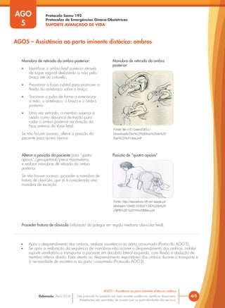 Protocolo Samu 192
Protocolos de Emergências Gineco-Obstétricas
SUPORTE AVANÇADO DE VIDA
Este protocolo foi pautado nas mais recentes evidências científicas disponíveis.
Adaptações são permitidas de acordo com as particularidades dos serviços.
Elaboração: Abril/2016
AGO
5
4/5
AGO5 – Assistência ao parto iminente distócico: ombros
AGO5 – Assistência ao parto iminente distócico: ombros
Manobra de retirada do ombro posterior:
• Identificar o ombro fetal posterior através
de toque vaginal deslizando a mão pelo
braço até ao cotovelo;
• Pressionar a fossa cubital para promover a
flexão do antebraço sobre o braço;
• Tracionar o pulso de forma a exteriorizar
a mão, o antebraço, o braço e o ombro
posterior.
• Uma vez extraído, o membro superior é
usado como alavanca de tração para
rodar o ombro posterior na direção da
face anterior do tórax fetal.
Se não houver sucesso, alterar a posição da
paciente para quatro apoios.
Alterar a posição da paciente para “quatro
apoios”/genupeitoral/prece maometana,
e realizar manobras de retirada do ombro
posterior.
Se não houver sucesso, proceder a manobra de
fratura de clavícula, que já é considerada uma
manobra de exceção.
Proceder fratura de clavícula (utilização do polegar em região mediana clavicular fetal).
Fonte: file:///C:/Users/DELL/
Downloads/Dist%C3%B3cia%20de%20
Esp%C3%A1dua.pdf
Fonte: http://repositorio.hff.min-saude.pt/
bitstream/10400.10/934/1/DO%20e%20
LNPB%20-%2016%20Maio.pdf
• Após o desprendimento dos ombros, realizar assistência ao parto consumado (Protocolo AGO3);
• Se após a realização da sequência de manobras não ocorrer o desprendimento dos ombros, instalar
suporte ventilatório e transportar a paciente em decúbito lateral esquerdo, com flexão e abdução de
membro inferior direito. Estar atento ao desprendimento espontâneo dos ombros durante o transporte e
à necessidade de assistência ao parto consumado (Protocolo AGO3).
Manobra de retirada do ombro
posterior
Posição de “quatro apoios”
 
