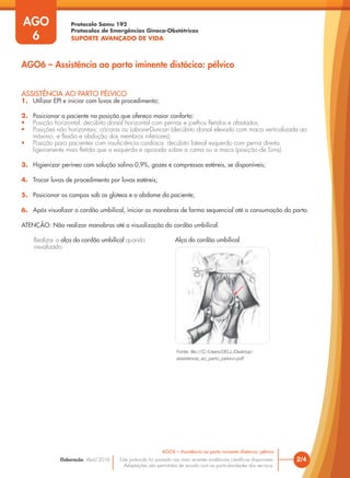 Protocolo Samu 192
Protocolos de Emergências Gineco-Obstétricas
SUPORTE AVANÇADO DE VIDA
Este protocolo foi pautado nas mais recentes evidências científicas disponíveis.
Adaptações são permitidas de acordo com as particularidades dos serviços.
Elaboração: Abril/2016
AGO
6
2/4
AGO6 – Assistência ao parto iminente distócico: pélvico
AGO6 – Assistência ao parto iminente distócico: pélvico
ASSISTÊNCIA AO PARTO PÉLVICO
1. Utilizar EPI e iniciar com luvas de procedimento;
2. Posicionar a paciente na posição que ofereça maior conforto:
• Posição horizontal: decúbito dorsal horizontal com pernas e joelhos fletidos e afastados;
• Posições não horizontais: cócoras ou Laborie-Duncan (decúbito dorsal elevado com maca verticalizada ao
máximo, e flexão e abdução dos membros inferiores);
• Posição para pacientes com insuficiência cardíaca: decúbito lateral esquerdo com perna direita
ligeiramente mais fletida que a esquerda e apoiada sobre a cama ou a maca (posição de Sims).
3. Higienizar períneo com solução salina 0,9%, gazes e compressas estéreis, se disponíveis;
4. Trocar luvas de procedimento por luvas estéreis;
5. Posicionar os campos sob os glúteos e o abdome da paciente;
6. Após visualizar o cordão umbilical, iniciar as manobras de forma sequencial até a consumação do parto.
ATENÇÃO: Não realizar manobras até a visualização do cordão umbilical.
Realizar a alça do cordão umbilical quando
visualizado.
Fonte: file:///C:/Users/DELL/Desktop/
assistencia_ao_parto_pelvico.pdf
Alça do cordão umbilical
 