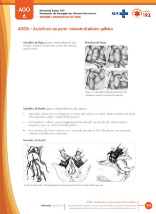 Protocolo Samu 192
Protocolos de Emergências Gineco-Obstétricas
SUPORTE AVANÇADO DE VIDA
Este protocolo foi pautado nas mais recentes evidências científicas disponíveis.
Adaptações são permitidas de acordo com as particularidades dos serviços.
Elaboração: Abril/2016 3/4
AGO6 – Assistência ao parto iminente distócico: pélvico
AGO
6
AGO6 – Assistência ao parto iminente distócico: pélvico
Manobra de Rojas para o desprendimento dos
ombros: realizar movimentos suaves de rotação
axial do feto.
Manobra de Bracht, para o desprendimento da cabeça:
• apreender o feto com os polegares ao longo das coxas e os quatro dedos restantes de cada
mão aplicados sobre a região lombossacra;
• horizontalizar o dorso, que é progressivamente elevado na direção do ventre materno,
fazendo-o girar ao redor da sínfise púbica;
• Se o excesso de vernix caseosa ou a umidade da pele do feto dificultarem sua preensão,
pode-se envolvê-lo em compressa.
Fonte: C:/Users/DELL/Downloads/Partos%20
cesarea%20pelvico%20e%20forceps.pdf
Fonte: C:/Users/DELL/Downloads/Partos%20cesarea%20pelvico%20e%20forceps.pdf
Manobra de Rojas
Manobra de Bracht
 