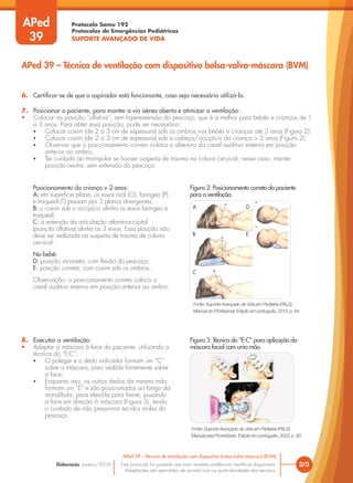 Protocolo Samu 192
Protocolos de Emergências Pediátricas
SUPORTE AVANÇADO DE VIDA
Este protocolo foi pautado nas mais recentes evidências científicas disponíveis.
Adaptações são permitidas de acordo com as particularidades dos serviços.
Elaboração: Janeiro/2016 2/3
APed 39 – Técnica de ventilação com dispositivo bolsa-valva-máscara (BVM)
APed 39 – Técnica de ventilação com dispositivo bolsa-valva-máscara (BVM)
APed
39
6. Certificar-se de que o aspirador está funcionante, caso seja necessário utilizá-lo.
7. Posicionar o paciente, para manter a via aérea aberta e otimizar a ventilação:
• Colocar na posição “olfativa”, sem hiperextensão do pescoço, que é a melhor para bebês e crianças de 1
a 3 anos. Para obter essa posição, pode ser necessário:
• Colocar coxim (de 2 a 3 cm de espessura) sob os ombros nos bebês e crianças até 2 anos (Figura 2);
• Colocar coxim (de 2 a 3 cm de espessura) sob a cabeça/occipício da criança > 2 anos (Figura 2);
• Observar que o posicionamento correto coloca a abertura do canal auditivo externo em posição
anterior ao ombro;
• Ter cuidado ao manipular se houver suspeita de trauma na coluna cervical; nesse caso, manter
posição neutra, sem extensão do pescoço.
8. Executar a ventilação:
• Adaptar a máscara à face do paciente, utilizando a
técnica do “E-C”:
• O polegar e o dedo indicador formam um “C”
sobre a máscara, para vedá-la firmemente sobre
a face;
• Enquanto isso, os outros dedos da mesma mão
formam um “E” e são posicionados ao longo da
mandíbula, para elevá-la para frente, puxando
a face em direção à máscara (Figura 3), tendo
o cuidado de não pressionar tecidos moles do
pescoço.
Figura 2: Posicionamento correto do paciente
para a ventilação.
Figura 3: Técnica do “E-C” para aplicação da
máscara facial com uma mão.
Posicionamento da criança > 2 anos:
A: em superfície plana, os eixos oral (O), faríngeo (P)
e traqueal (T) passam por 3 planos divergentes;
B: o coxim sob o occipício alinha os eixos faríngeo e
traqueal;
C: a extensão da articulação atlanto-occipital
(posição olfativa) alinha os 3 eixos. Essa posição não
deve ser realizada na suspeita de trauma de coluna
cervical.
No bebê:
D: posição incorreta, com flexão do pescoço;
E: posição correta, com coxim sob os ombros.
Observação: o posicionamento correto coloca o
canal auditivo externo em posição anterior ao ombro.
Fonte: Suporte Avançado de Vida em Pediatria (PALS).
Manual para Provedores. Edição em português, 2003, p. 93.
Fonte: Suporte Avançado de Vida em Pediatria (PALS).
Manual do Profissional. Edição em português, 2012, p. 64.
A D
B E
C
 