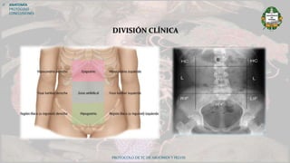 PROTOCOLO DE TC DE ABDOMEN Y PELVIS
DIVISIÓN CLÍNICA
 ANATOMÍA
PROTOCOLO
CONCLUSIONES
 