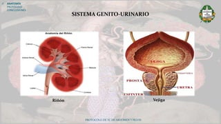 PROTOCOLO DE TC DE ABDOMEN Y PELVIS
 ANATOMÍA
PROTOCOLO
CONCLUSIONES
SISTEMA GENITO-URINARIO
Riñón Vejiga
 