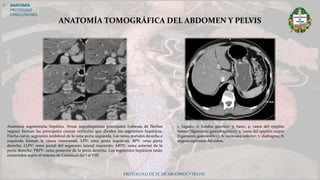PROTOCOLO DE TC DE ABDOMEN Y PELVIS
ANATOMÍA TOMOGRÁFICA DEL ABDOMEN Y PELVIS
 ANATOMÍA
PROTOCOLO
CONCLUSIONES
Anatomía segmentaria hepática. Venas suprahepáticas principales (cabezas de flechas
negras) forman las principales cisuras verticales que dividen los segmentos hepáticos.
Flecha curva: segmento umbilical de la vena porta izquierda. Las venas portales derecha e
izquierda forman la cisura transversal. LPV: vena porta izquierda; RPV: vena porta
derecha; LLPV: rama portal del segmento lateral izquierdo; ARPV: rama anterior de la
porta derecha; PRPV: rama posterior de la porta derecha. Los segmentos hepáticos están
numerados según el sistema de Couinaud del I al VIII.
1: hígado; 2: fundus gástrico; 3: bazo; 4: vasos del epiplón
menor (ligamento gastrohepático); 5: vasos del epiplón mayor
(ligamento gastrocólico); 6: vena cava inferior; 7: diafragma; 8:
ángulo esplénico del colon.
 