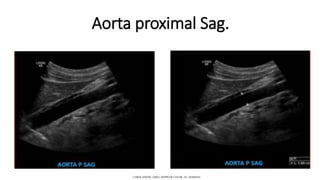 Aorta proximal Sag.
CAROL KREBS. (2001). DOPPLER COLOR. EU: MARBAN.
 
