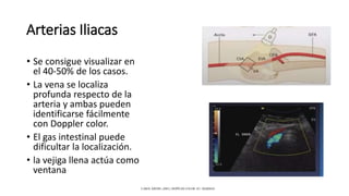 Arterias Iliacas
• Se consigue visualizar en
el 40-50% de los casos.
• La vena se localiza
profunda respecto de la
arteria y ambas pueden
identificarse fácilmente
con Doppler color.
• El gas intestinal puede
dificultar la localización.
• la vejiga llena actúa como
ventana
CAROL KREBS. (2001). DOPPLER COLOR. EU: MARBAN.
 