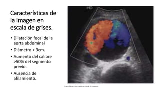 Características de
la imagen en
escala de grises.
• Dilatación focal de la
aorta abdominal
• Diámetro > 3cm.
• Aumento del calibre
>50% del segmento
previo.
• Ausencia de
afilamiento.
CAROL KREBS. (2001). DOPPLER COLOR. EU: MARBAN.
 