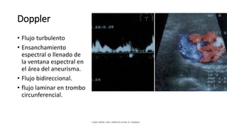 Doppler
• Flujo turbulento
• Ensanchamiento
espectral o llenado de
la ventana espectral en
el área del aneurisma.
• Flujo bidireccional.
• flujo laminar en trombo
circunferencial.
CAROL KREBS. (2001). DOPPLER COLOR. EU: MARBAN.
 