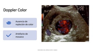 Doppler Color
Ausencia de
repleción de color
Artefacto de
mosaico
CAROL KREBS. (2001). DOPPLER COLOR. EU: MARBAN.
 