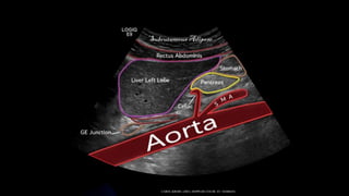 CAROL KREBS. (2001). DOPPLER COLOR. EU: MARBAN.
 