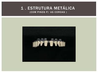 1 . ESTRUTURA METÁLICA
( C O M P I N O S P / A S C O R OA S )

 