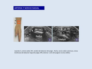 ARTERIA Y NERVIO RADIAL

Leyenda: A, arteria radial; APL, tendón del abductor del pulgar , flecha, nervio radial; asteriscos, ramas
tendinosas del abductor largo del pulgar, EPB, extensor corto del pulgar,V, la vena cefálica

 
