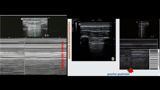 protocolo fast protocolo fast ecografia .pptx