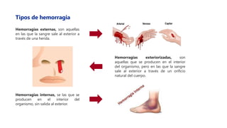 Tipos de hemorragia
Hemorragias externas, son aquellas
en las que la sangre sale al exterior a
través de una herida.
Hemorragias exteriorizadas, son
aquellas que se producen en el interior
del organismo, pero en las que la sangre
sale al exterior a través de un orificio
natural del cuerpo.
Hemorragias internas, se las que se
producen en el interior del
organismo, sin salida al exterior.
 