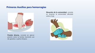Primeros Auxilios para hemorragias
Presión directa, consiste en ejercer
presión sobre la herida, haciendo uso
de apósitos o paños limpios.
Elevación de la extremidad, consiste
en levantar la extremidad afectada
sobre el eje.
 