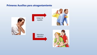 Primeros Auxilios para atragantamiento
Maniobra
Heimlich
Golpe de
espalda
 