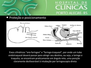 Eixos cilíndricos "oro-faríngeo" e "faringo-traqueal", por onde um tubo
endotraqueal deverá passar para atingir seu destino, ou seja, a laringe e
traquéia, se encontram praticamente em ângulo reto, uma posição
claramente desfavorável à intubação por laringoscopia direta
● Proteção e posicionamento
 
