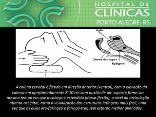 A coluna cervical é fletida em direção anterior (ventral), com a elevação da
cabeça em aproximadamente 8-10 cm com auxílio de um suporte firme; ao
mesmo tempo em que a cabeça é estendida (dorso-flexão), a nível da articulação
atlanto-occipital, torna a visualização das estruturas laríngeas mais fácil, uma
vez que os eixos oro-faríngeo e faringo-traqueal estarão melhor alinhados.
 