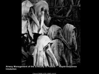 Airway Management of the Critically Ill Patient * : Rapid-Sequence
Intubation
 