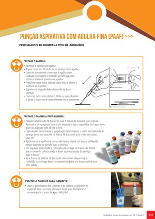 149Avaliação e manejo de pacientes com TB // Versão 1
Punção aspirativa com agulha fina (PAAF) >>>
PREPARE A AMOSTRA PARA GENEXPERT
•	Após a preparação das lâminas e da cultura, o restante do
material deve ser colocado num meio para transporte e
enviado para o teste de Xpert MTB/RIF
PREPARE A LÂMINA:
•	Remova a seringa da agulha
•	Aspire cerca de 10ml de ar na seringa sem agulha
•	Conecte novamente a seringa à agulha com
cuidado e pressione o êmbolo da seringa para
retirar o material contido na agulha
•	Pressione uma outra lâmina sobre esta e deixe o
material se espalhar
•	Separe em seguida delicadamente as duas
lâminas
•	Fixe uma delas com álcool a 90% ou spray fixador
e deixe a outra secar naturalmente no ar ambiente
PREPARE O MATERIAL PARA CULTURA:
•	Prepare o frasco do TB Bactec® para o envio da amostra para cultura
Remova a tampa protectora e em seguida limpe a superfície do frasco com
gaze ou algodão com álcool a 70%
•	Logo depois de terminar a preparação das lâminas, o resto do conteúdo da
seringa deve ser inserido no frasco TB Bactec® com meio de cultura
para TB
•	Após inserir a agulha na tampa do frasco, aspire um pouco do líquido
escuro contido na garrafa para a seringa
•	Em seguida, insira todo o conteúdo da seringa no frasco, de forma
que o meio de cultura ajude a levar todo conteúdo da seringa
para o frasco
•	Se o frasco de cultura TB Bactec® não estiver disponível, o
conteúdo da seringa deve ser transferido para um frasco estéril com
soro salino
PROCESSAMENTO DE AMOSTRAS A NÍVEL DO LABORATÓRIO
 