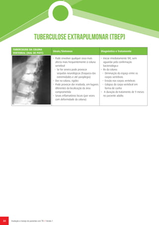 30 Avaliação e manejo de pacientes com TB // Versão 1
Tuberculose Extrapulmonar (TBEP)
TUBERCULOSE DA COLUNA
VERTEBRAL (MAL DE POTT)
Sinais/Sintomas Diagnóstico e Tratamento
•	 Pode envolver qualquer osso mais
afecta mais frequentemente à coluna
vertebral
-	 Se for severa pode provocar
sequelas neurológicas (fraqueza das
extremidades e até paraplegia)
•	 Dor na coluna, rigidez
•	 Pode provocar dor irradiada, em lugares
diferentes da localização da área
comprometida
•	 Sinais inflamatórios locais (por vezes
com deformidade da coluna)
•	 Iniciar imediatamente TAT, sem
aguardar pela confirmação
bacteriológica
•	 Rx da coluna:
-	 Diminuição do espaço entre os
corpos vertebrais
-	 Erosão nos corpos vertebrais
-	 Colapso do corpo vertebral em
forma de cunha
•	 A duração do tratamento de 9 meses
no paciente adulto.
 