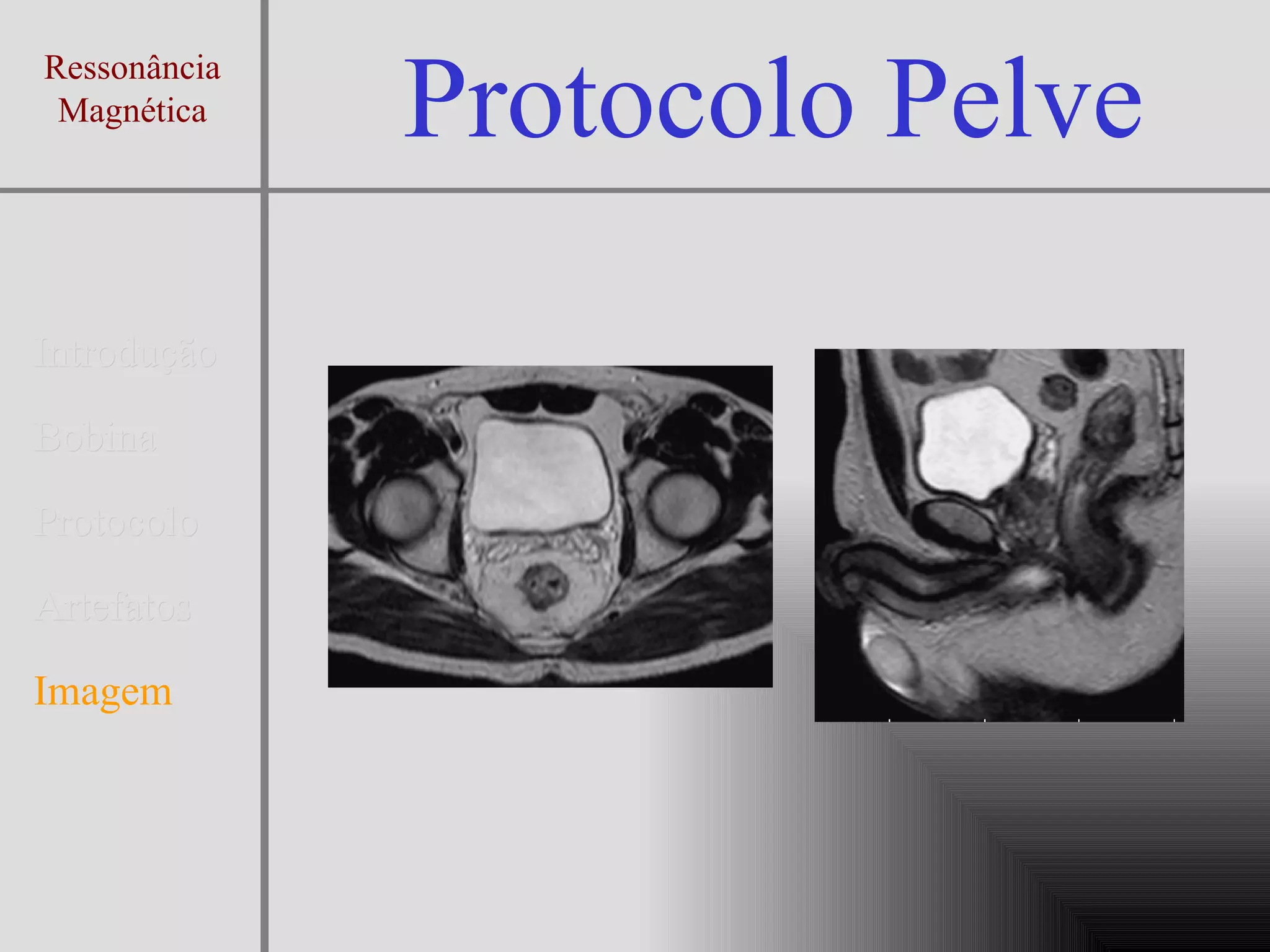 Protocolo Exame de Ressonancia Magnética da Pelve | PPT | Medical Health