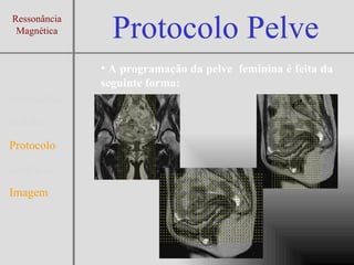 Protocolo Exame de Ressonancia Magnética da Pelve | PPT