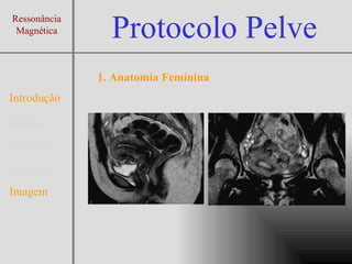 Protocolo Exame de Ressonancia Magnética da Pelve | PPT