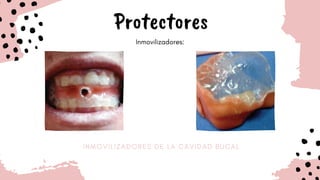 I N M O V I L I Z A D O R E S D E L A C A V I D A D B U C A L
Protectores
Inmovilizadores:
 