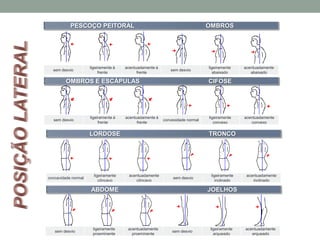LORDOSE TRONCO
OMBROS E ESCÁPULAS CIFOSE
PESCOÇO PEITORAL OMBROS
ABDOME JOELHOS
sem desvio
ligeiramente
proeminente
acentuadamente
proeminente
sem desvio
ligeiramente
arqueado
acentuadamente
arqueado
concavidade normal
ligeiramente
côncavo
acentuadamente
côncavo
sem desvio
ligeiramente
inclinado
acentuadamente
inclinado
sem desvio
ligeiramente à
frente
acentuadamente à
frente
convexidade normal
ligeiramente
convexo
acentuadamente
convexo
sem desvio
ligeiramente à
frente
acentuadamente à
frente
sem desvio
ligeiramente
abaixado
acentuadamente
abaixado
 
