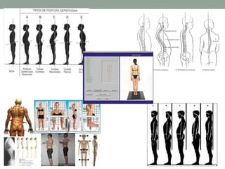 • Protocolo de análise postural
• Observação subjetiva
• Segmentos corporais analisados: Cabeça, ombros,
coluna, tronco, t...