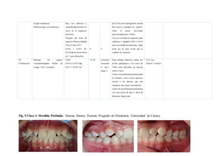 33
Fig. 9 Clase I. Mordida Profunda. Sistema Damon. Paciente Posgrado de Ortodoncia. Universidad de Cuenca.
torque remanente.
Sobrecorregir verticalmente.
fase con elásticos y
expanda ligeramente los
arcos en el segmento
posterior.
Después del cierre de
espacios DamonOptimal
Force Cobre NiTi
0.018 x 0.025 S/I.
Extienda los arcos hasta
los 7 para alinearlos.
8 8
de 0.10 a través del gancho mesial
del resorte y póngalo en “pigtail”
sobre el poste, activando
aproximadamente 10mm.
Una vez cerrados los espacios, pase
cadeneta o ligadura 0.08 ó 0.010
para consolidarlos anteriores, ligue
atrás los 6s para evitar que se
reabran los espacios.
IV.
Finalización
Realizar los ajustes
vestibulolinguales finales de
torque. A/P y oclusales.
TMA
0.019 x 0.025 Sup
0.017 x 0.025 Inf
15-20 4-6 hasta
seccionar
el arco,
luego 2.
Para utilizar elásticos, ajuste los
postes quirúrgicos a los arcos de
TMA para distribuir las fuerzas
sobre el arco.
Como otraopciónpara perfeccionar
la oclusión, corte el arco superior
mesial a los dientes que aún
requieren una mejor articulación.´
Ajuste las interferencias posteriores
con una pieza de alta y fresa de
diamante luego pula.
3/16; 2oz
Clase II “cortitos”
 