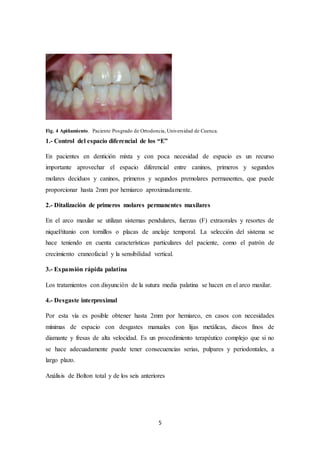 5
Fig. 4 Apiñamiento. Paciente Posgrado de Ortodoncia, Universidad de Cuenca.
1.- Control del espacio diferencial de los “E”
En pacientes en dentición mixta y con poca necesidad de espacio es un recurso
importante aprovechar el espacio diferencial entre caninos, primeros y segundos
molares deciduos y caninos, primeros y segundos premolares permanentes, que puede
proporcionar hasta 2mm por hemiarco aproximadamente.
2.- Ditalización de primeros molares permanentes maxilares
En el arco maxilar se utilizan sistemas pendulares, fuerzas (F) extraorales y resortes de
niquel/titanio con tornillos o placas de anclaje temporal. La selección del sistema se
hace teniendo en cuenta características particulares del paciente, como el patrón de
crecimiento craneofacial y la sensibilidad vertical.
3.- Expansión rápida palatina
Los tratamientos con disyunción de la sutura media palatina se hacen en el arco maxilar.
4.- Desgaste interproximal
Por esta vía es posible obtener hasta 2mm por hemiarco, en casos con necesidades
mínimas de espacio con desgastes manuales con lijas metálicas, discos finos de
diamante y fresas de alta velocidad. Es un procedimiento terapéutico complejo que si no
se hace adecuadamente puede tener consecuencias serias, pulpares y periodontales, a
largo plazo.
Análisis de Bolton total y de los seis anteriores
 