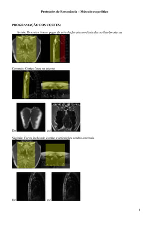 Protocolos de Ressonância – Músculo-esquelético
PROGRAMAÇÃO DOS CORTES:
Axiais: Os cortes devem pegar da articulação esterno-clavicular ao fim do esterno
Coronais: Cortes finos no esterno
De até
Sagitais: Cortes incluindo esterno e articulções condro-esternais
De até
1
 