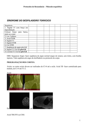 Protocolos de Ressonância – Músculo-esquelético
SÍNDROME DO DESFILADEIRO TORÁCICO
Sequência
1. Sagital T1 com braço em
hiperabdução
Colocar braço para baixo,
junto ao corpo
2. Loc 3 planos
3. Axial STIR
4. Sagital T1
5. Sagital STIR
6. Cor STIR
7. Seqüência de angio pós-Gd
8. Sagital T1 Fat Sat pós-Gd
9. Coronal T1 Fat Sat pós-Gd
OBS: Sequencia Angio: fazer seqüência de angio normal (angio de renais), sem tricks, com bomba
injetora. Vide seqüência de angio de desfiladeiro no protocolo do corpo.
PROGRAMAÇÃO DOS CORTES:
Axiais: os cortes axiais devem ser realizados de C3-4 até a axila. Axial 3D fazer centralizado para
medula, de C3-4 até T1-2.
Axial:
De até
Axial TRUFFI ou CISS
1
 