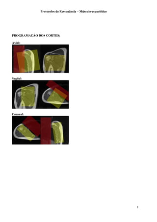 Protocolos de Ressonância – Músculo-esquelético
PROGRAMAÇÃO DOS CORTES:
Axial:
Sagital:
Coronal:
1
 