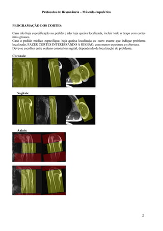 Protocolos de Ressonância – Músculo-esquelético
PROGRAMAÇÃO DOS CORTES:
Caso não haja especificação no pedido e não haja queixa localizada, incluir todo o braço com cortes
mais grossos.
Caso o pedido médico especifique, haja queixa localizada ou outro exame que indique problema
localizado, FAZER CORTES INTERESSANDO A REGIÃO, com menor espessura e cobertura.
Deve-se escolher entre o plano coronal ou sagital, dependendo da localização do problema.
Coronais:
Sagitais:
Axiais:
2
 