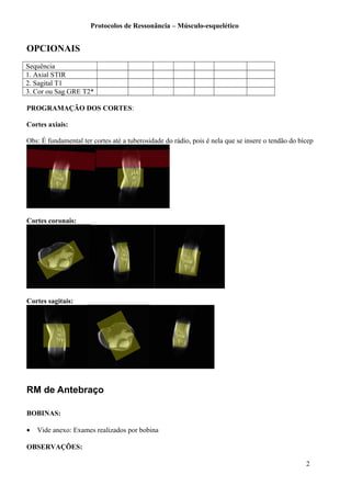Protocolos de Ressonância – Músculo-esquelético
OPCIONAIS
Sequência
1. Axial STIR
2. Sagital T1
3. Cor ou Sag GRE T2*
PROGRAMAÇÃO DOS CORTES:
Cortes axiais:
Obs: É fundamental ter cortes até a tuberosidade do rádio, pois é nela que se insere o tendão do bícep
Cortes coronais:
Cortes sagitais:
RM de Antebraço
BOBINAS:
• Vide anexo: Exames realizados por bobina
OBSERVAÇÕES:
2
 