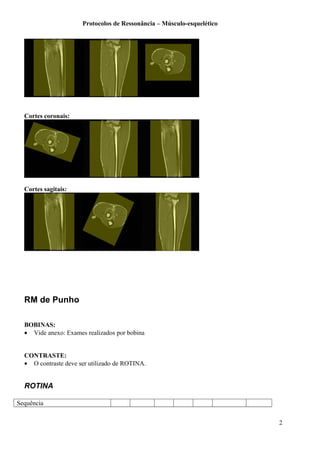 Protocolos de Ressonância – Músculo-esquelético
Cortes coronais:
Cortes sagitais:
RM de Punho
BOBINAS:
• Vide anexo: Exames realizados por bobina
CONTRASTE:
• O contraste deve ser utilizado de ROTINA.
ROTINA
Sequência
2
 