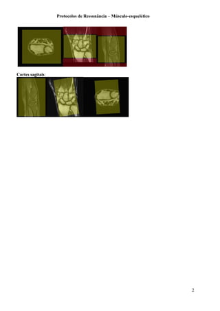 Protocolos de Ressonância – Músculo-esquelético
Cortes sagitais:
2
 