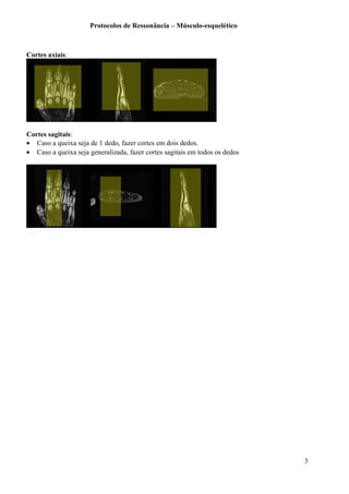 Protocolos de Ressonância – Músculo-esquelético
Cortes axiais:
Cortes sagitais:
• Caso a queixa seja de 1 dedo, fazer cortes em dois dedos.
• Caso a queixa seja generalizada, fazer cortes sagitais em todos os dedos
3
 